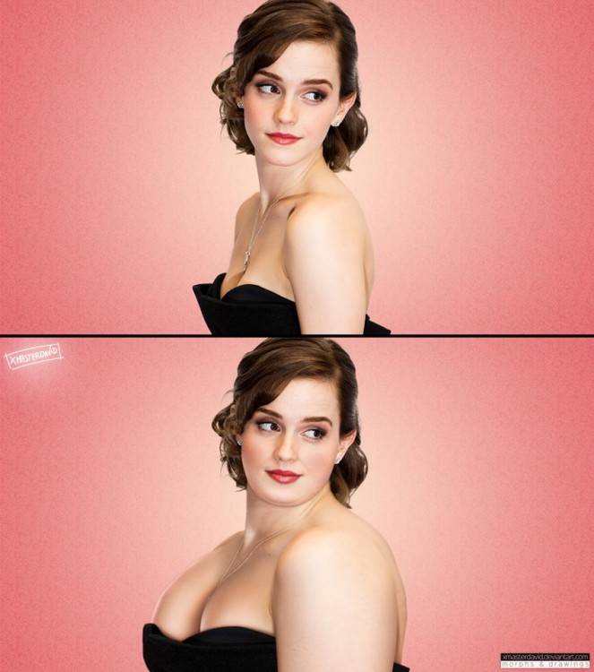 Antes y después de Emma Watson con sobrepeso por David Lopera 