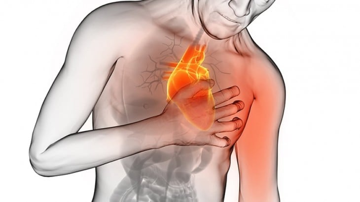 Dibujo de una persona tocando su pecho mientras recibe un ataque al corazón 