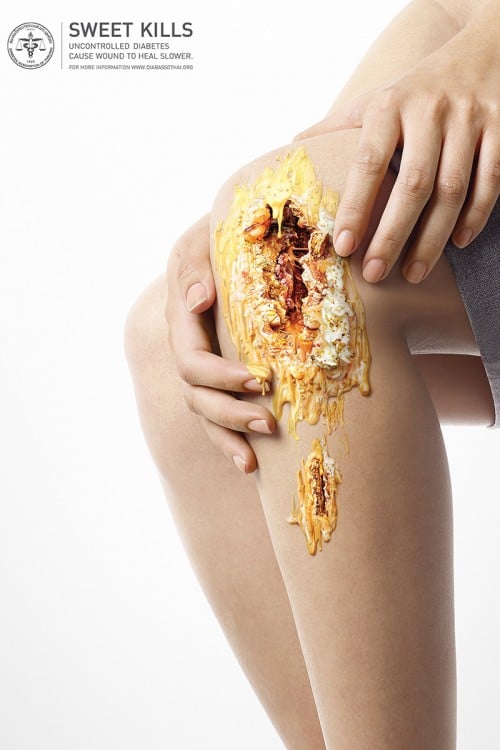campaña publicitaria contra la diabetes con una herida dulce sobre la pierna de una persona 