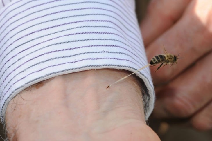 abeja picando brazo