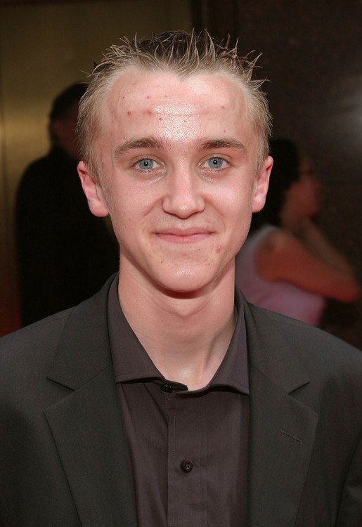 Tom Felton (Draco Malfoy)