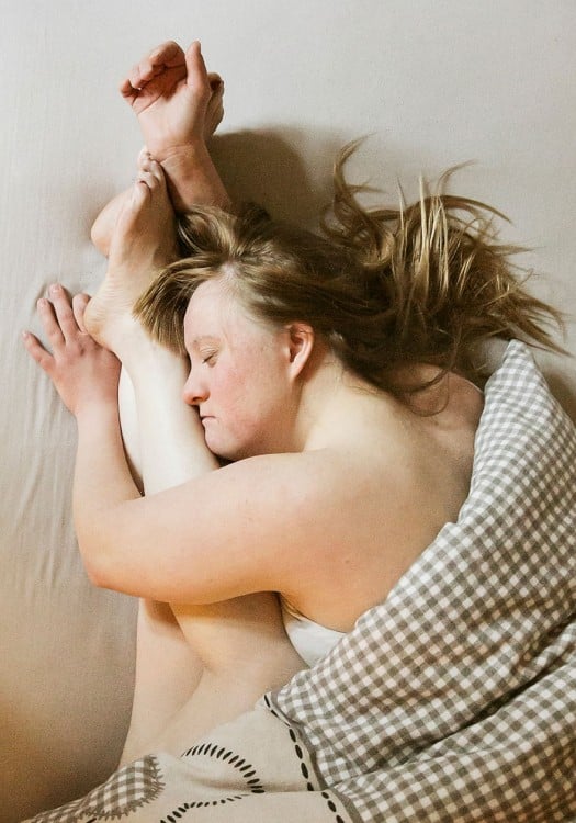 Mujer con sindrome de Down abrazando una pierna 