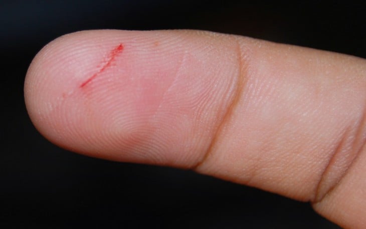 Parte de un dedo cortado con papel 