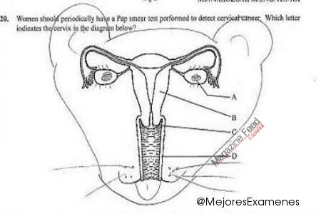 Dibujo en un examen del aparato reproductor femenino 