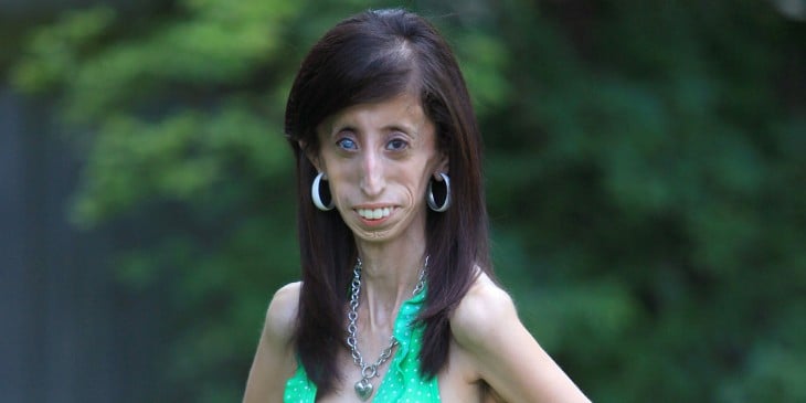 lizzie velasquez la mujer mas fea del mundo