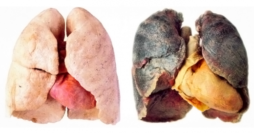 Pulmones