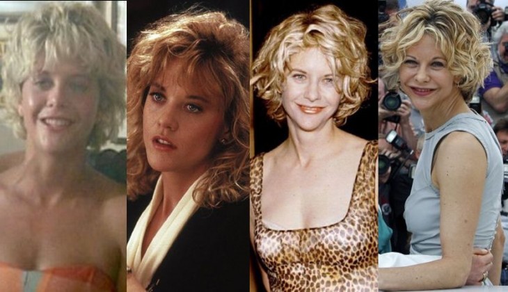 cirugias de meg ryan