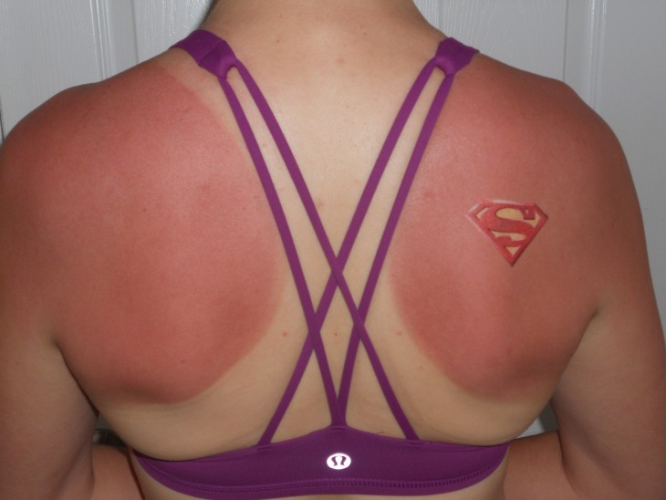 mujer con strapples marcados por el sol. en el homoplato derecho trae tatuaje con base de agua estilo escudo de superman
