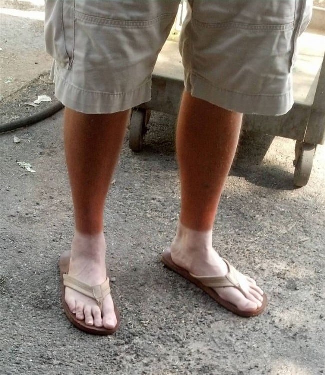 se le marcan los calcetines después de pasar varias horas en el sol