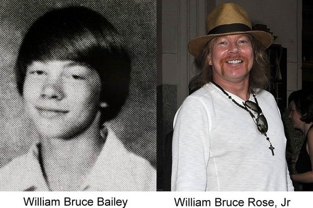 fotografía del antes y después del famosos Axl Rose 