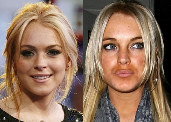 lindsay lohan con aumento de labios