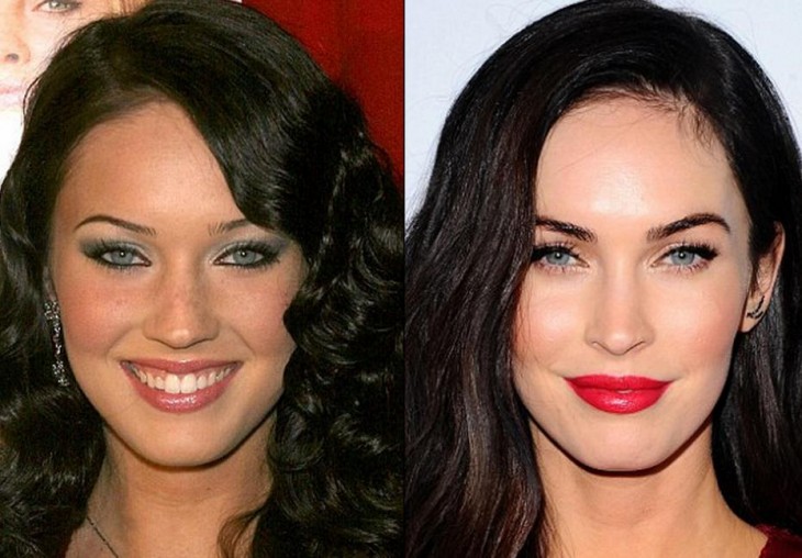 megan fox antes y despues de las cirugias