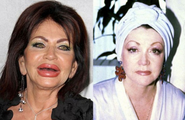 jackie stallone antes y despues