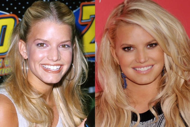 jessica simpson antes y despues de la cirugia de nariz