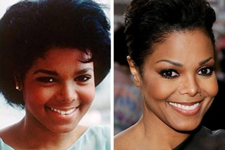 janet jackson antes y despues de la cirugia