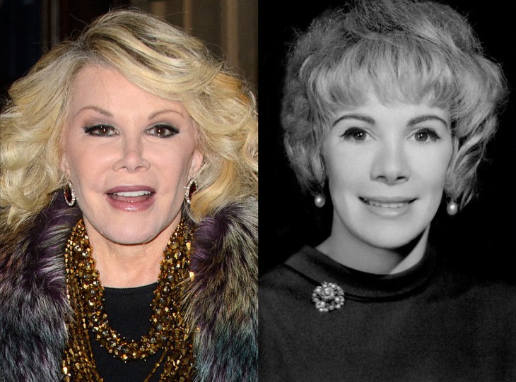 joan rivers antes y despues de las cirugias