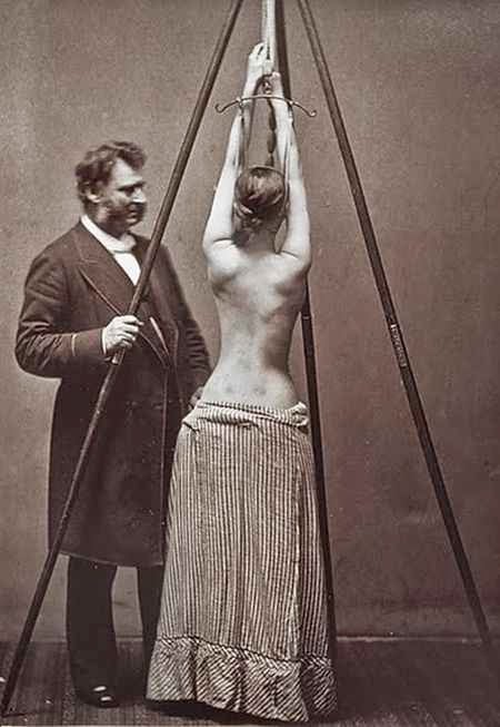Tratamiento de la escoliosis de Lewis Sayre