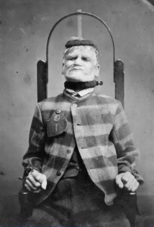 Paciente en silla de inmovilización en el West Riding Lunatic Asylum, Wakefield, Yorkshire. 1869