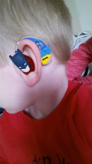 Cabeza de un niño que trae un audífono con diseño de batman