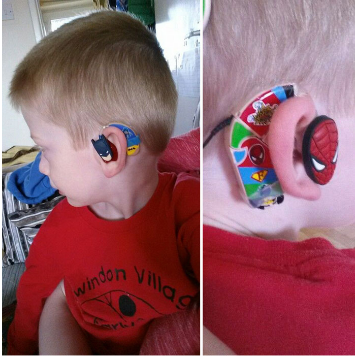 niño con un audífono en su oído 