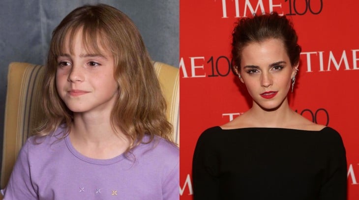 imagen del antes y después de la actriz Emma Watson 