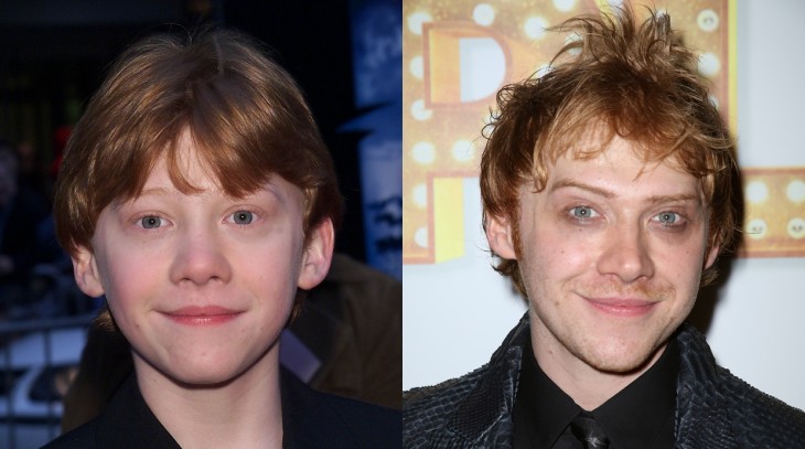 antes y después de Rupert Grint 