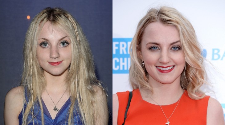 Evanna Lynch en una imagen con su antes y después 