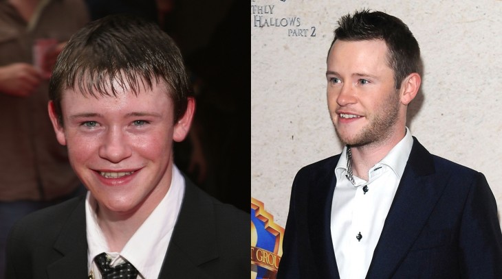 foto del antes y después de Devon Murray