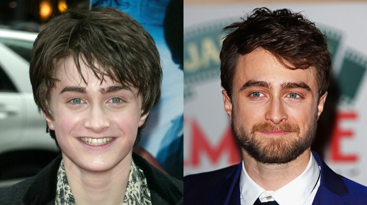 Fotografía del antes y después de Daniel Radcliffe