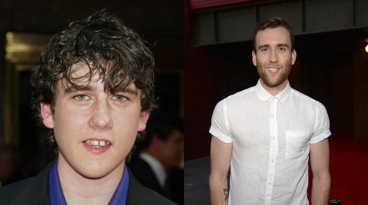 foto del antes y después de Matthew Lewis