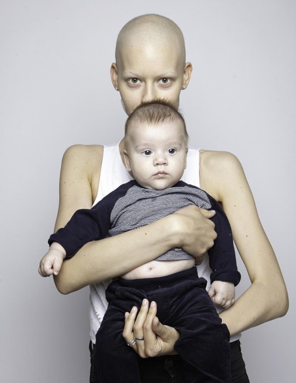 Elizaveta la modelo con cáncer de mandíbula cargando a su bebé frente a ella 