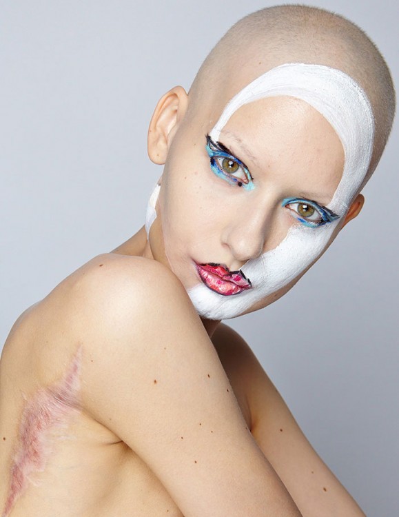 Modelo Elizaveta modelando y mostrando las cicatrices de su cirugía 