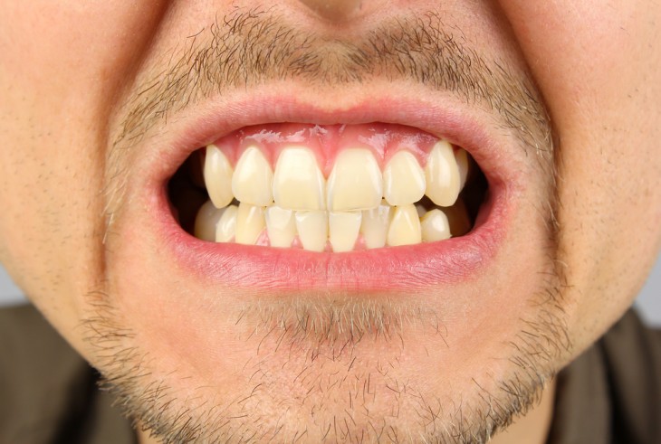 boca de un hombre mostrando los dientes 