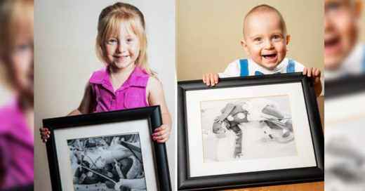 Hermosas fotos de estos premaruros niños en su antes y despues