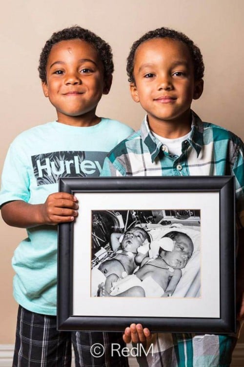 Dos niños sosteniendo un retrato entre los dos de cuando eran bebés prematuros 