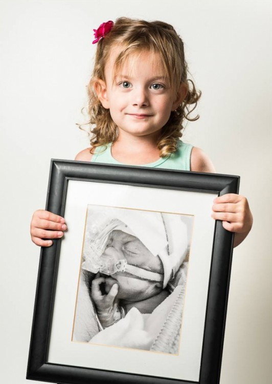 Niña con un retrato de ella cuando era bebé prematura 