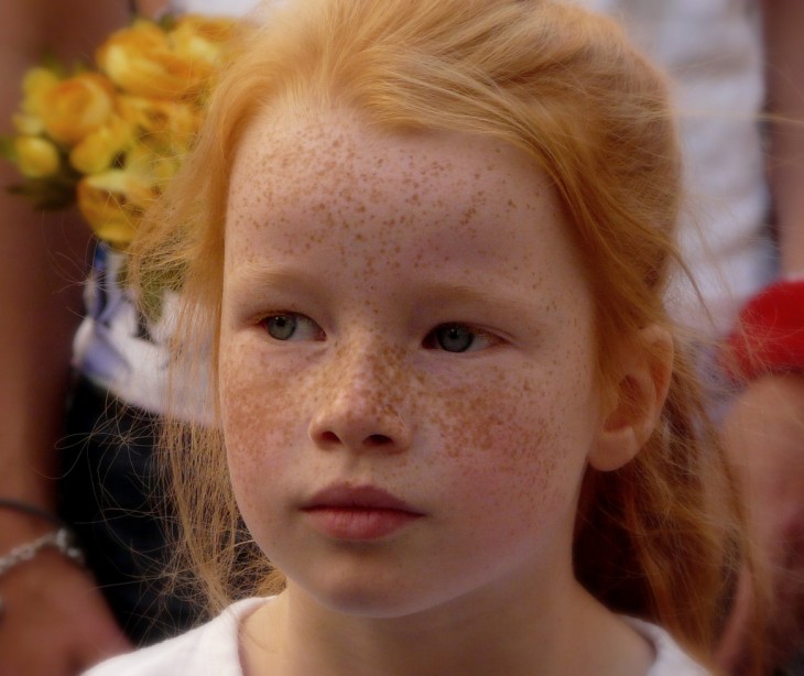 cara de una niña pelirroja con pecas en su cara 