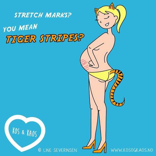 ilustración animada de las estrías en la barriga de una mujer embarazada 