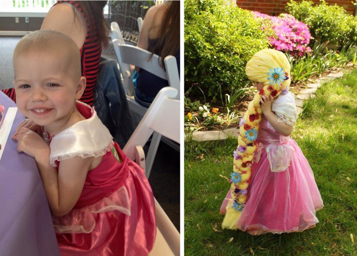 Antes y después de una niña de 2 años con cáncer 
