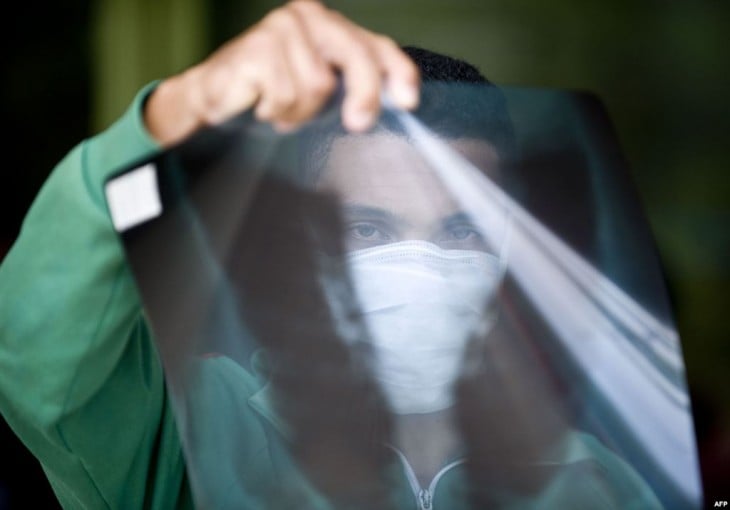 un hombre sosteniendo en su mano una radiografía 