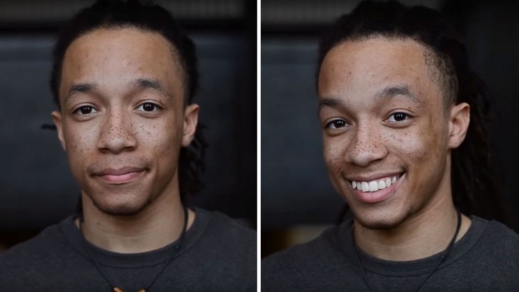 fotografía de un chico antes y después de sonreír 