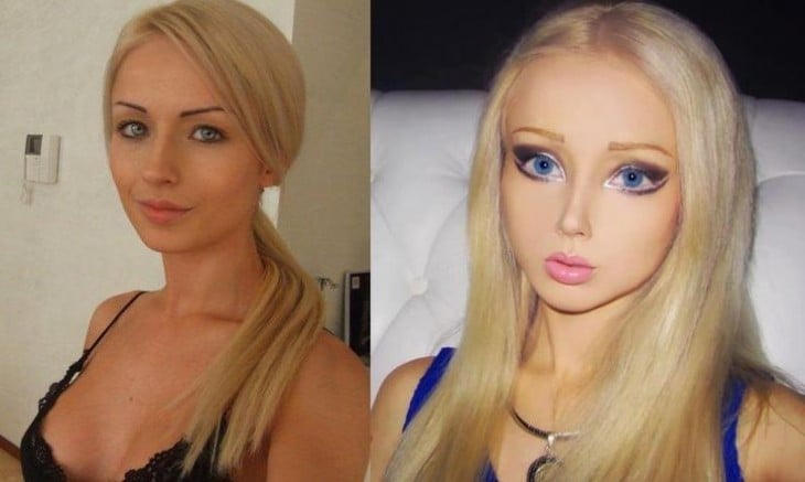 cara antes y después de las operaciones de Valeria Lukyanova 'La Barbie humana' 