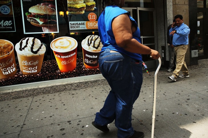 MUJER OBESA Y ENFERMA DE LAS PIERNAS POR EL SOBRE PESO