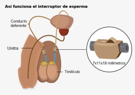 Dibujo que muestra como funciona el interruptor de esperma Bimek SLV 