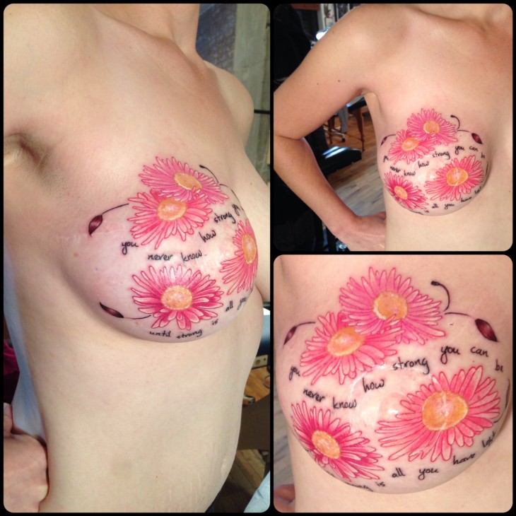 Fotografías del tatuaje sobre las cicatrices del seno de una mujer 