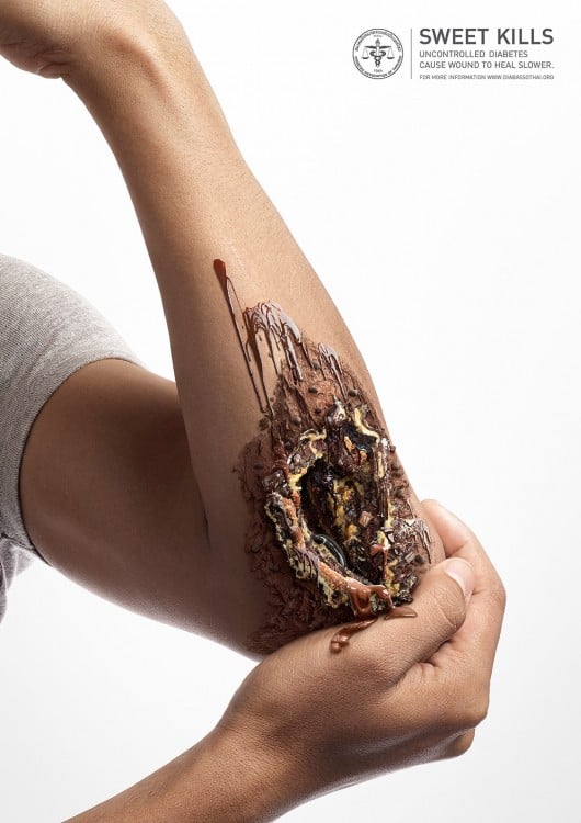 Sweet Kills campaña contra la diabetes imagen que muestra un brazo roto pero con un maquillaje de postre de chocolate 