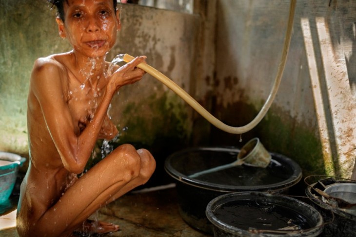 mujer bañándose en una jaula de un hospital mental en Indonesia 