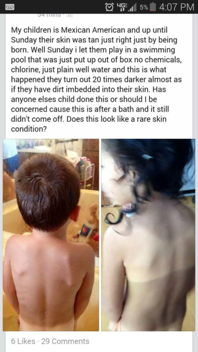 estado de internet en donde una mujer subió una foto de sus dos hijos bronceados y se preocupa porque puedan tener una extraña enfermedad en la piel