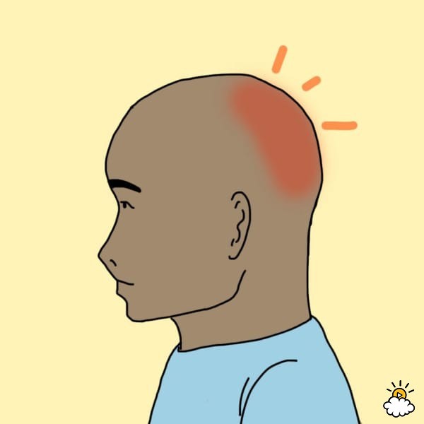 ilustración de persona con cosquilleo en la cabeza