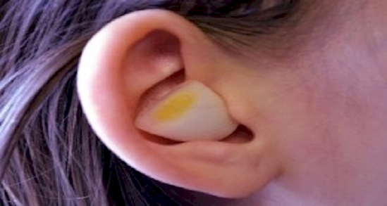 corazón de cebolla en la oreja